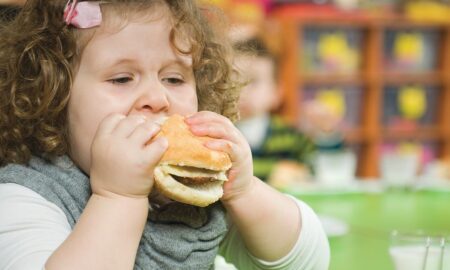 Overweight Kids