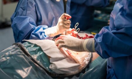 C-Section