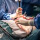 C-Section