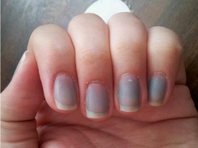 Lack of oxygen circulating in red blood cells turn the nails blue. 