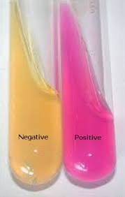 A hot-pink color is an indication of positive test for urease.