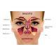 Sinus