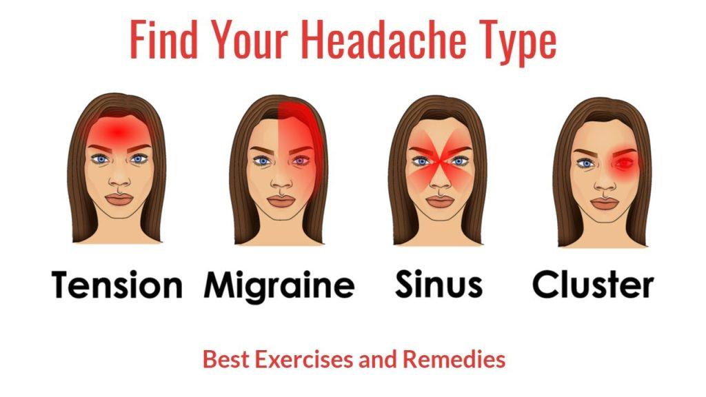 Types of Migraine