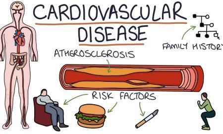 Cardiovascular diseases