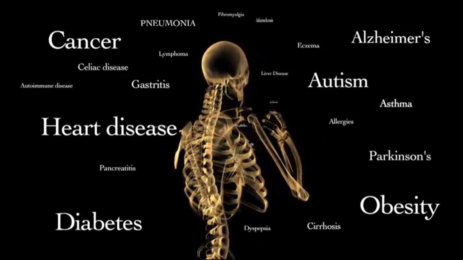 top ten disease in the world
