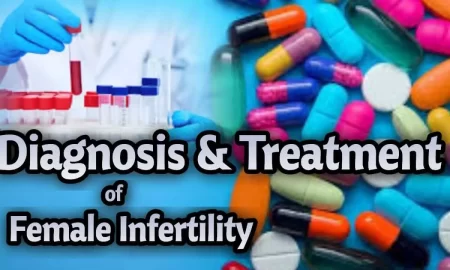 Diagnosis and Treatment of Female Infertility