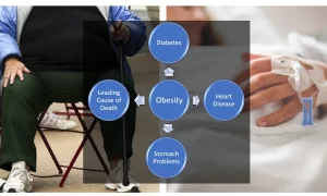 Obesity-consequences-death-diabetes-heart-disease-stomach-problems