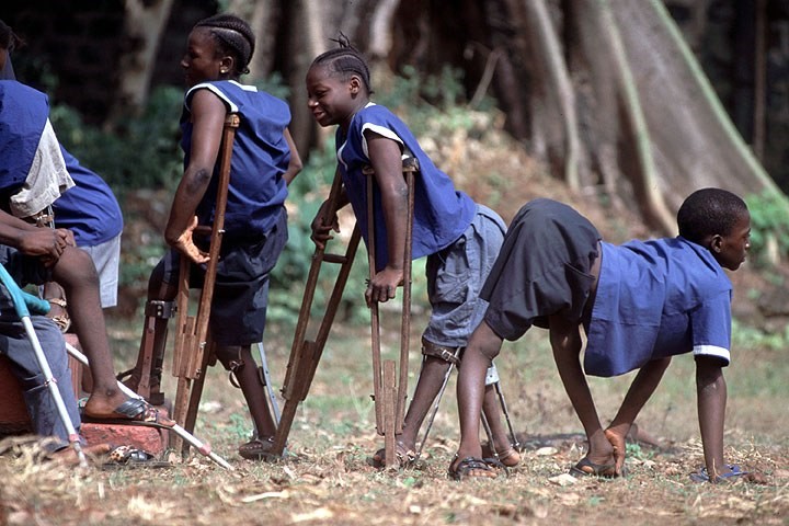 polio virus